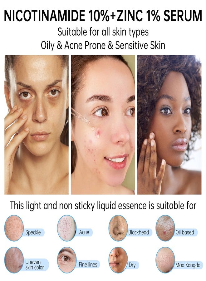 CHANGARLOAD Niacinamide 10%+ Zinc 1% Serum For Face, Niacinamide Serum For Face, Dermatologist, Redness Relieve-30ml 1floz, 2Pcs - Image 5